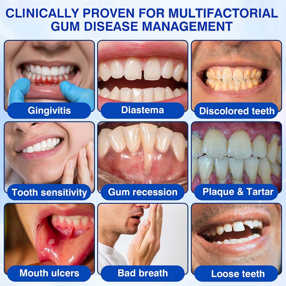 GumRevive Periodontal Repair Gel (for bleeding gums, receding gums, and loose teeth)