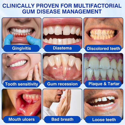 GumRevive Periodontal Repair Gel (for bleeding gums, receding gums, and loose teeth)