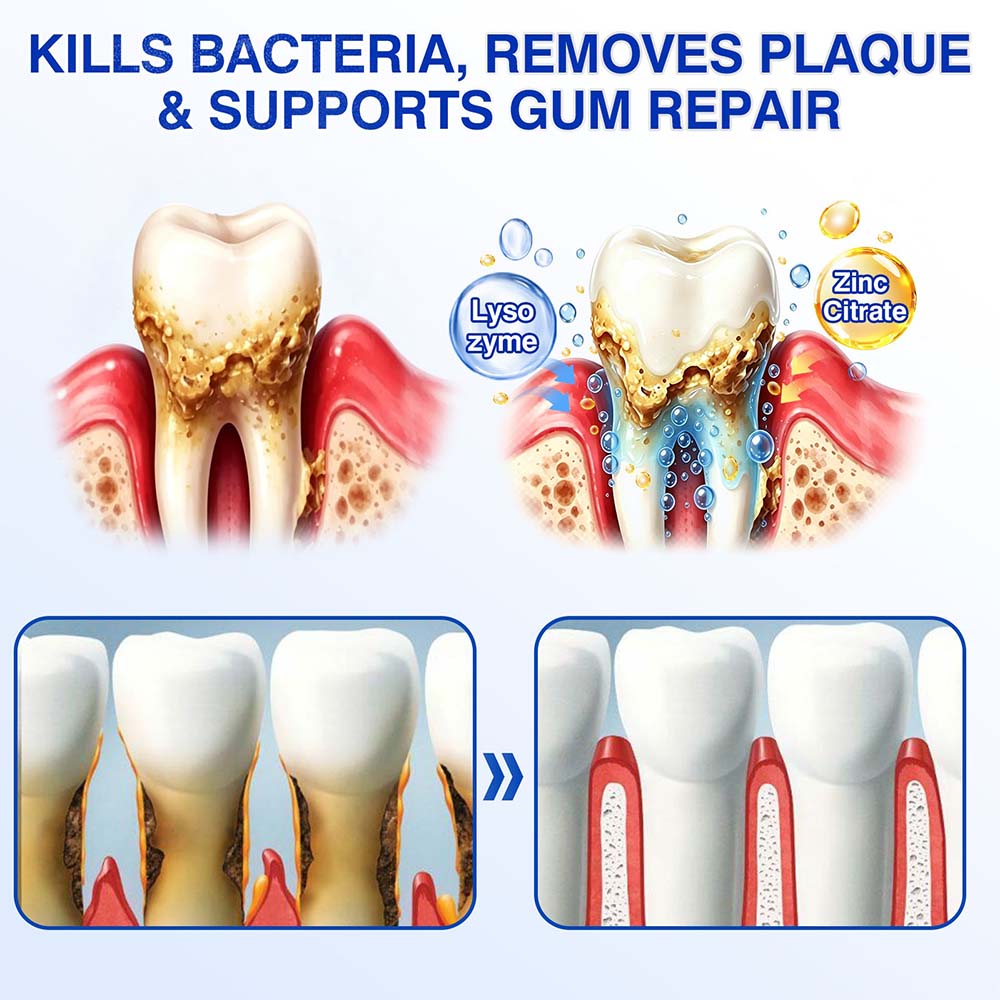 GumRevive Periodontal Repair Gel (for bleeding gums, receding gums, and loose teeth)