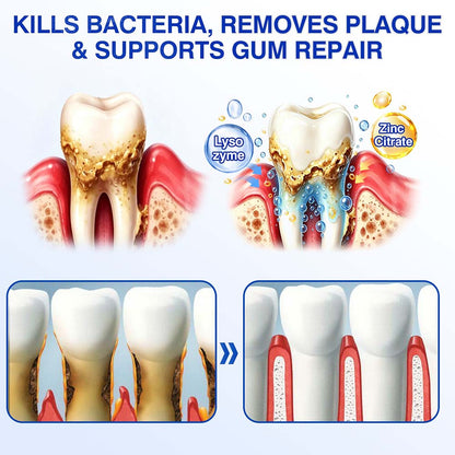GumRevive Periodontal Repair Gel (for bleeding gums, receding gums, and loose teeth)