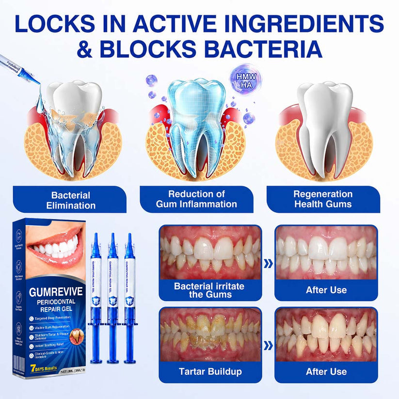 GumRevive Periodontal Repair Gel (for bleeding gums, receding gums, and loose teeth)