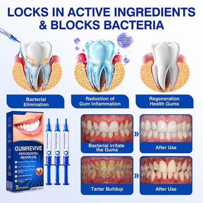 GumRevive Periodontal Repair Gel (for bleeding gums, receding gums, and loose teeth)