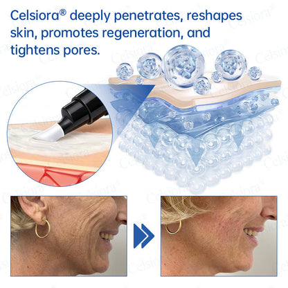 💧🔥UK HOT SALE Celsiora® PDRN Anti-Wrinkle Shot – Lift & Firming Cream