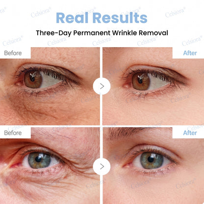 💧🔥UK HOT SALE Celsiora® PDRN Anti-Wrinkle Shot – Lift & Firming Cream