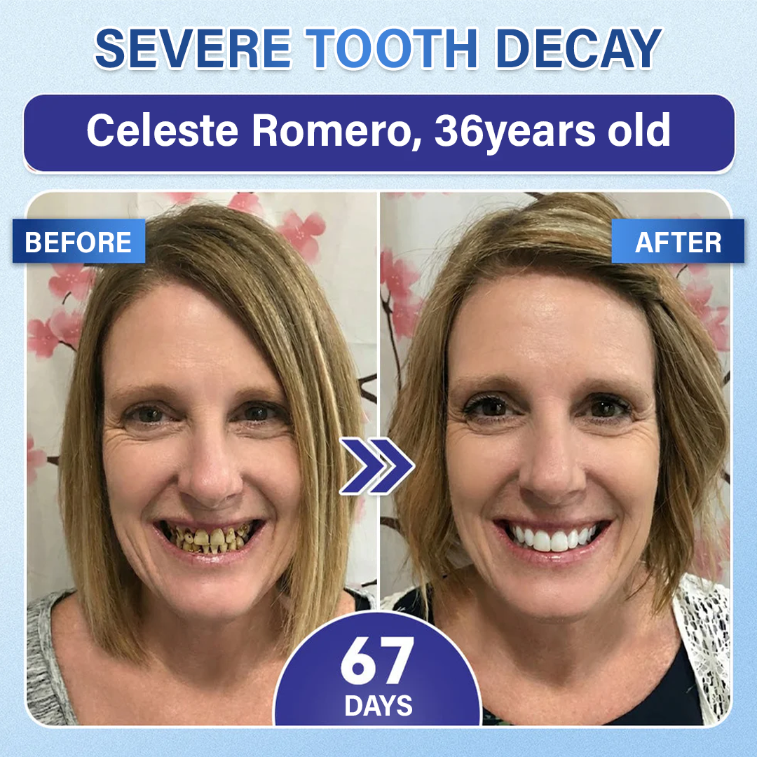 Your Smile🦷 Tooth & Gum Repair Fast-Dissolving Microneedle Patch✨