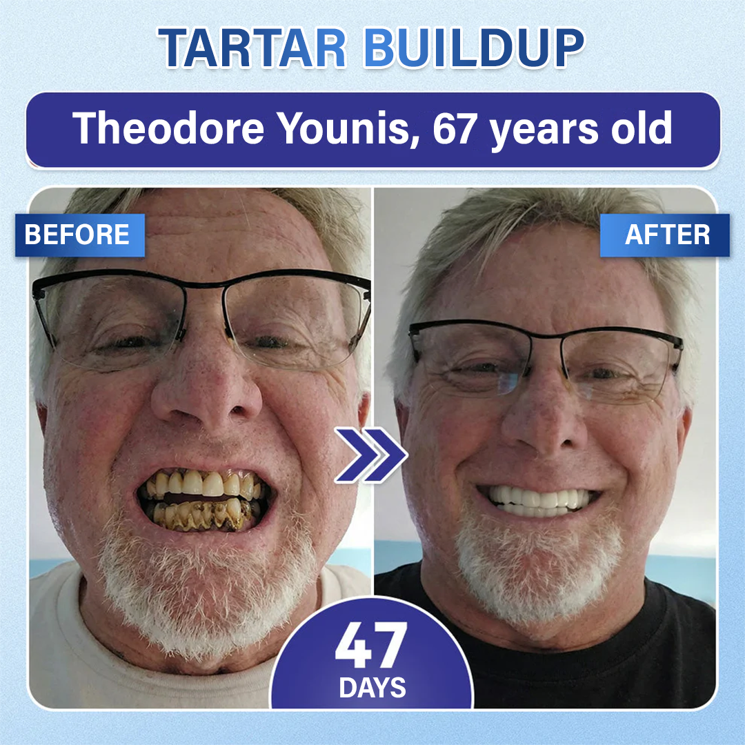 Your Smile🦷 Tooth & Gum Repair Fast-Dissolving Microneedle Patch✨