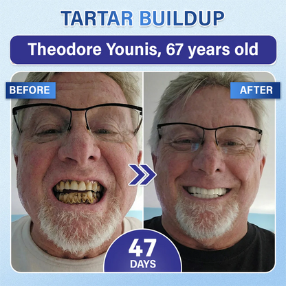 Your Smile🦷 Tooth & Gum Repair Fast-Dissolving Microneedle Patch✨