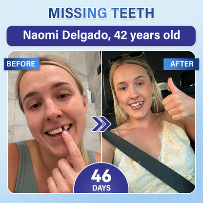 Your Smile🦷 Tooth & Gum Repair Fast-Dissolving Microneedle Patch✨