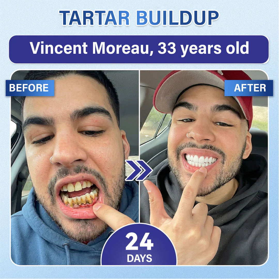 Your Smile🦷 Tooth & Gum Repair Fast-Dissolving Microneedle Patch✨