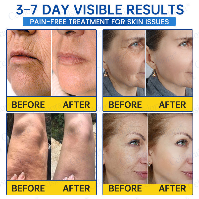 💧🔥UK HOT SALE Celsiora® PDRN Anti-Wrinkle Shot – Lift & Firming Cream