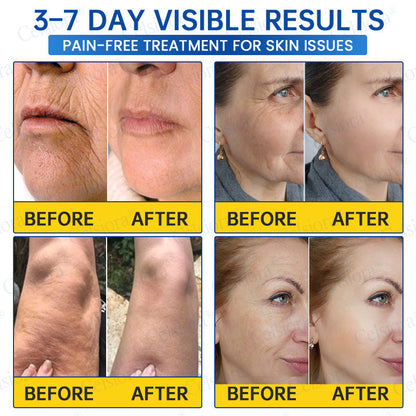 💧🔥UK HOT SALE Celsiora® PDRN Anti-Wrinkle Shot – Lift & Firming Cream