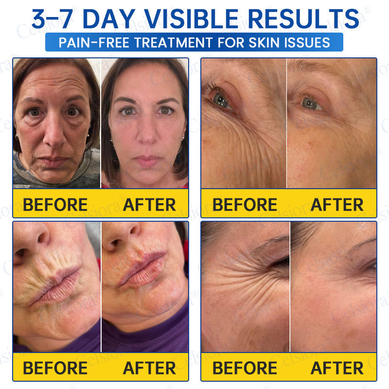 💧🔥UK HOT SALE Celsiora® PDRN Anti-Wrinkle Shot – Lift & Firming Cream
