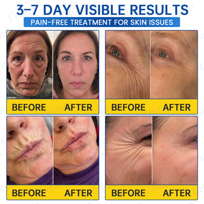 💧🔥UK HOT SALE Celsiora® PDRN Anti-Wrinkle Shot – Lift & Firming Cream