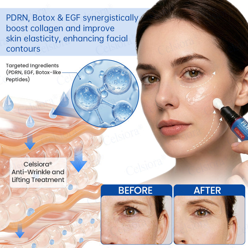 💧🔥UK HOT SALE Celsiora® PDRN Anti-Wrinkle Shot – Lift & Firming Cream