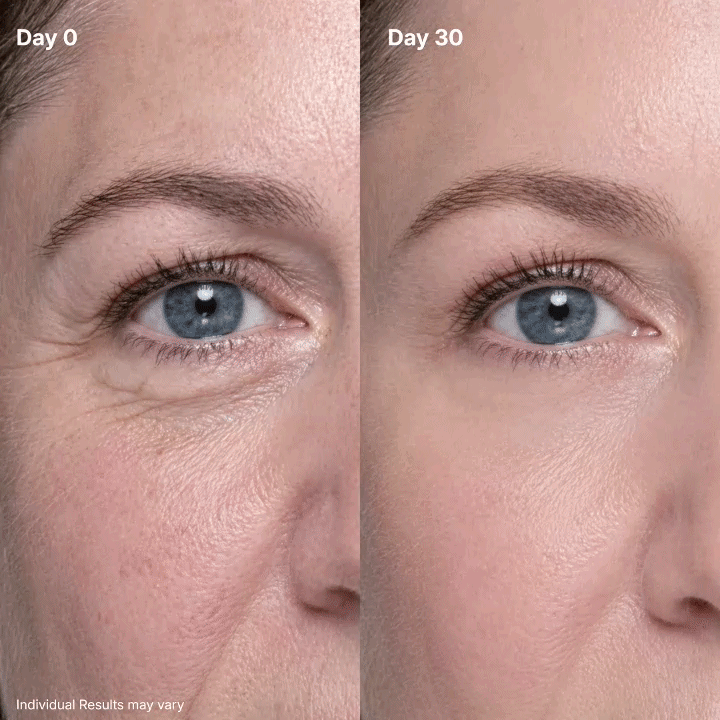 🎉Halloween Sale🎉Slimoly™ Eye Renewal CreamSlimoly™ Eye Renewal Cream